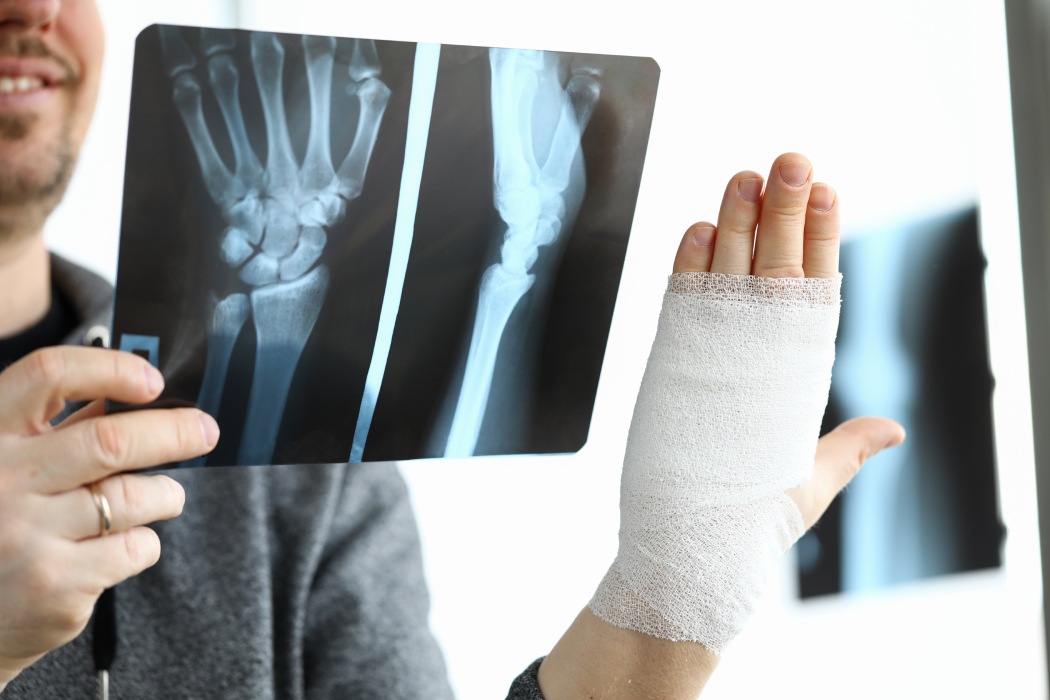 Doktor Lin léčí kosti za tři minuty... pomocí lepidla z ústřic, které se v Číně používá od 10. století k upevňování mostů