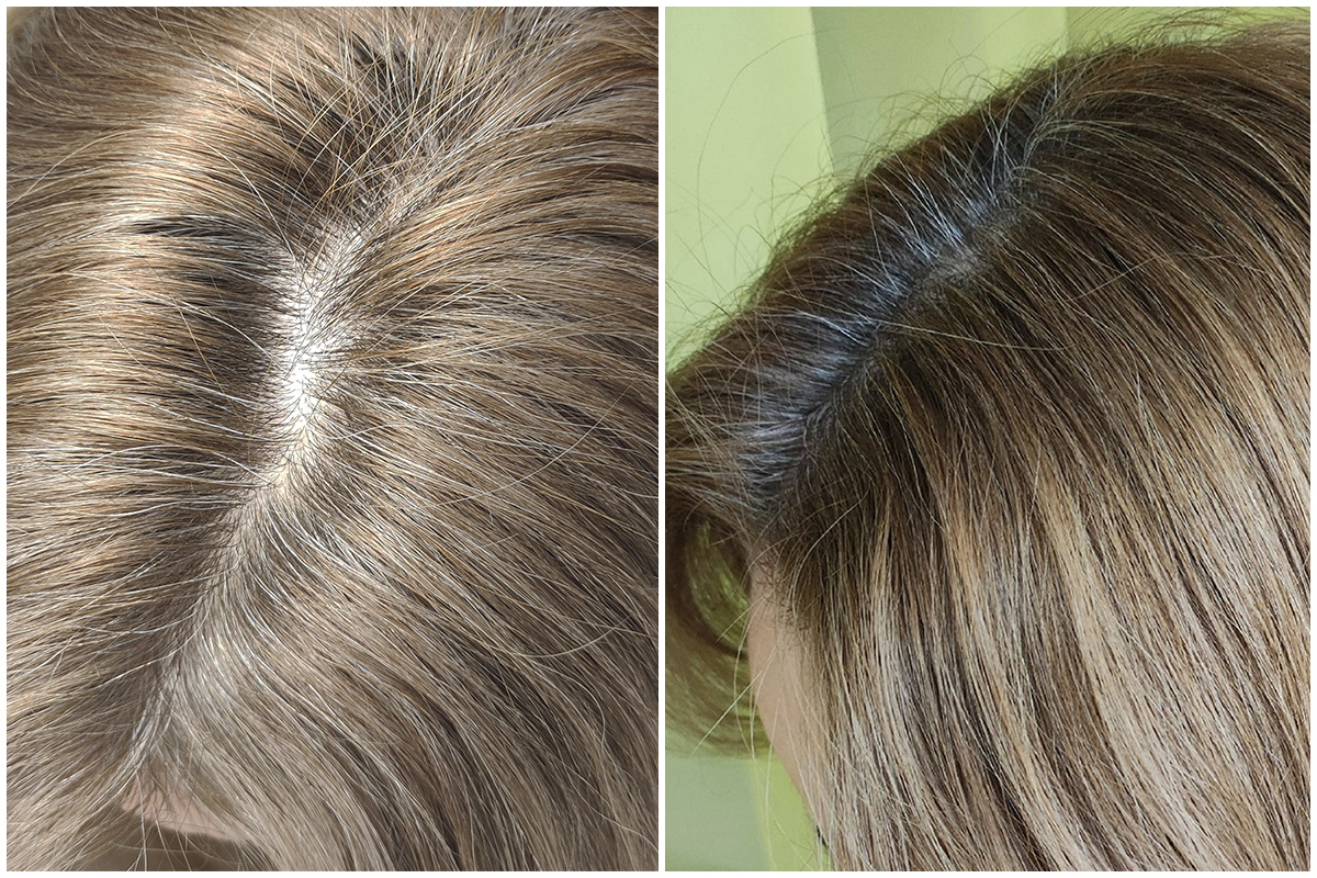 Jak se zbavit šedivých vlasů navždy: domácí prostředek bez barviv a chemikálií, který obnovuje barvu vlasů