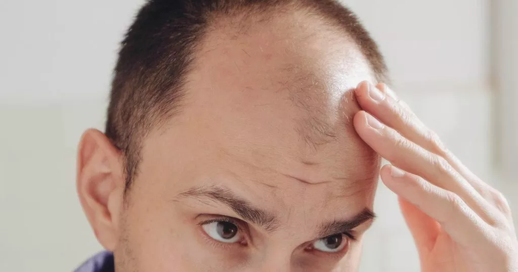 V roce 2024 si vědci stanovili za cíl vyvinout definitivní lék: podařilo se jim vytvořit nový prostředek proti alopecii.