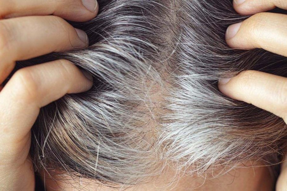 Proč používat hydrogenuhličitan sodný a rozmarýn k barvení šedivých vlasů a jak to dělat efektivně.