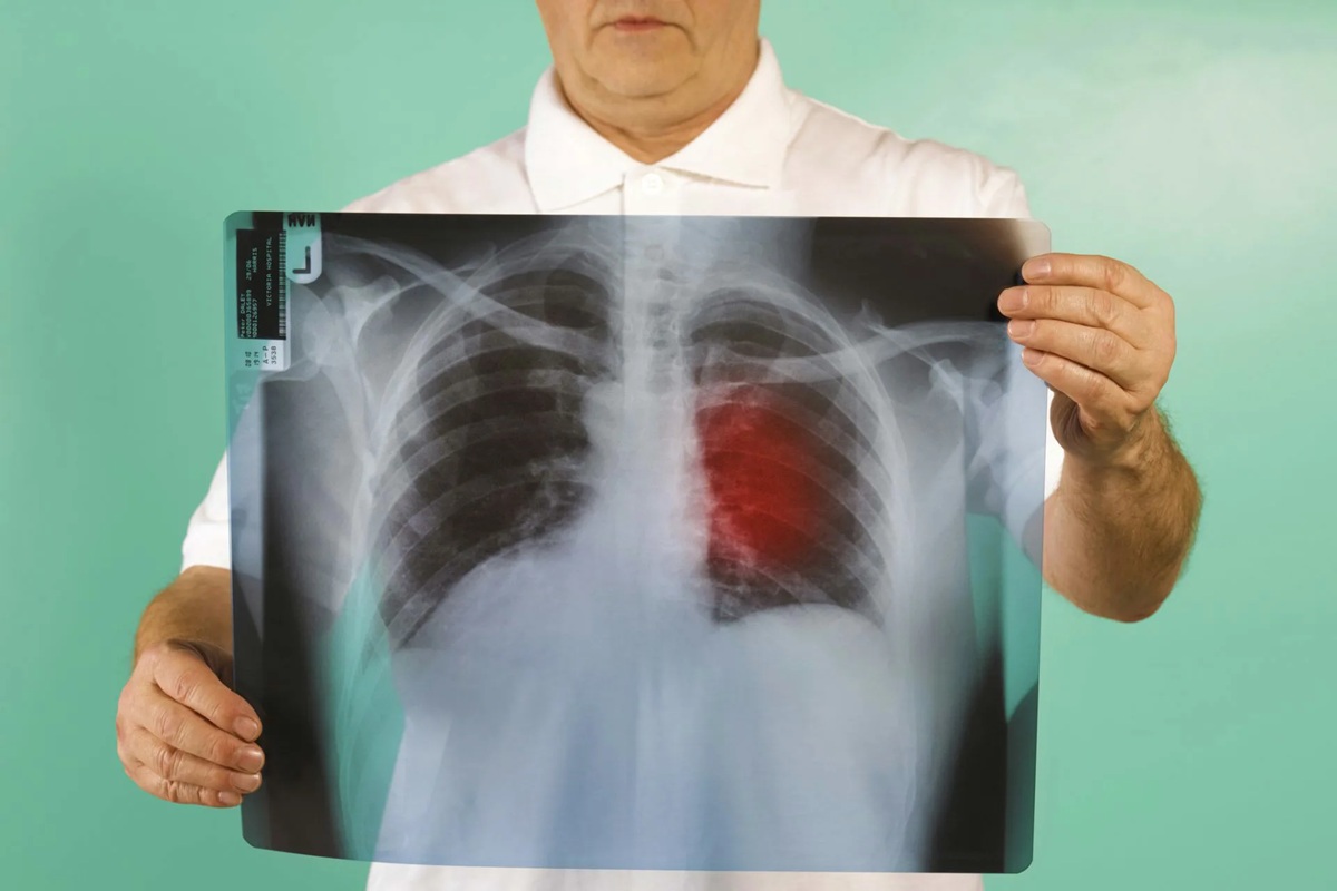 Jak gen velryby, testovaný na mouchách, může bojovat s rakovinou u lidí.