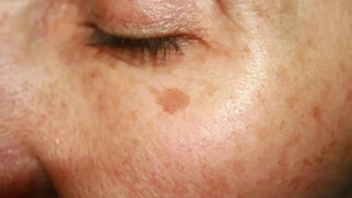 Smíchání banánové a citronové kůry: proč se to doporučuje a jaké jsou výhody