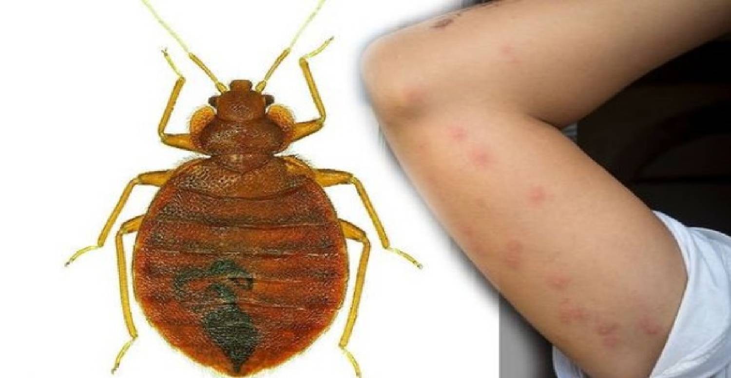 Prostředek proti štěnicím – hit na trhu? Němci ho používají už mnoho let!