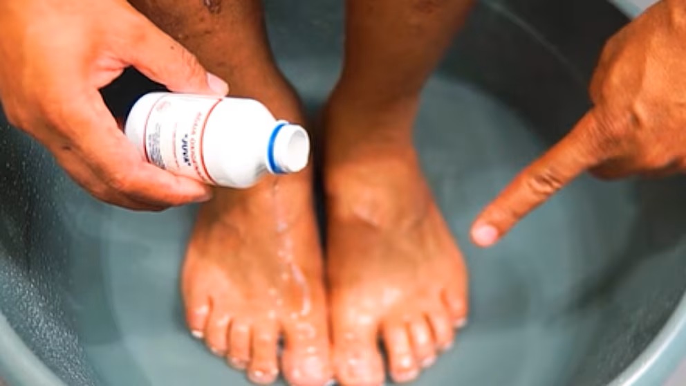 Domácí prostředek s peroxidem vodíku k odstranění plísní a nepříjemného zápachu nohou.