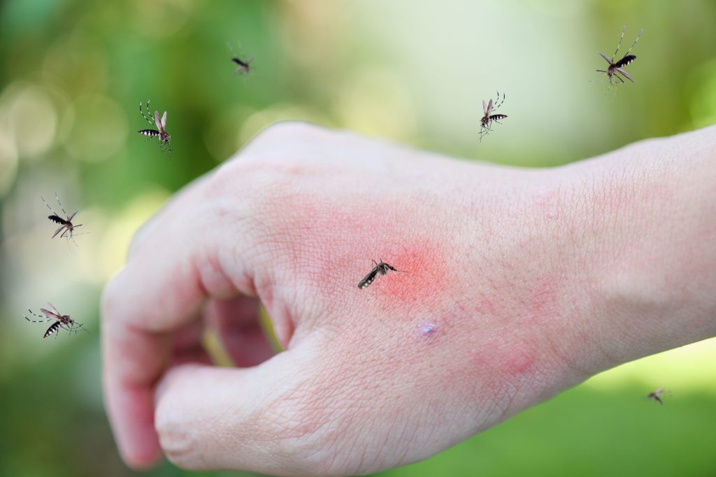 Sbohem svědění? Toto jednoduché gesto může ulevit od komárů během několika sekund, aniž byste utráceli peníze